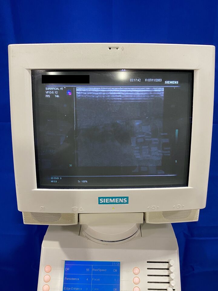 SIEMENS Sonoline G50 Ultrasound System