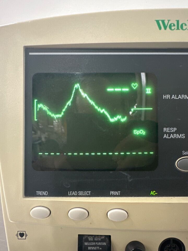 62000 SERIES Welch Allyn BP Monitor