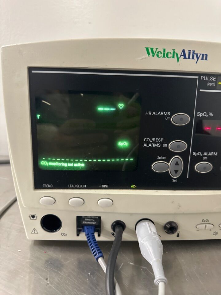 62000 SERIES Welch Allyn BP Monitor