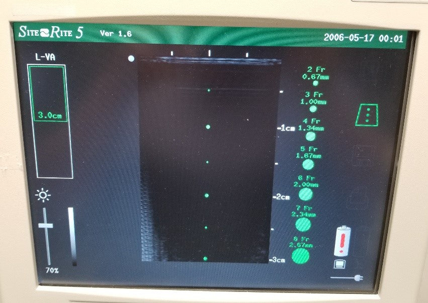 Bard Site-rite 5 Ultrasound